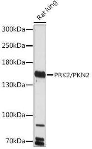 Western blot analysis of extracts of Rat lung, using Anti-PKN2 Antibody (A306089) at 1:1,000 dilution. The secondary antibody was Goat Anti-Rabbit IgG H&L Antibody (HRP) at 1:10,000 dilution.