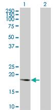 Anti-DUSP3 Mouse Polyclonal Antibody