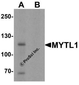 Western blot analysis of MYT1L in mouse brain tissue lysate with MYT1L antibody at 1 &#956;g/mL in (A) the absence and (B) the presence of blocking peptide.