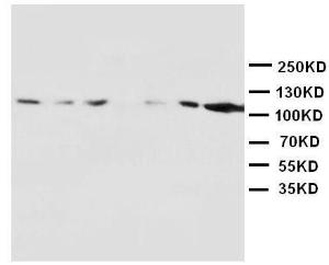 Anti-NMDAR1 Rabbit Polyclonal Antibody