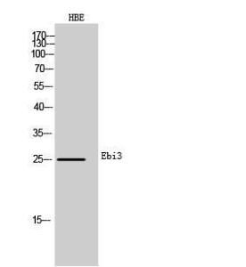 Anti-EBI3 Rabbit Polyclonal Antibody