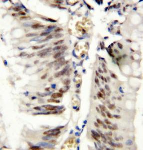 Anti-ATF4 Rabbit Polyclonal Antibody