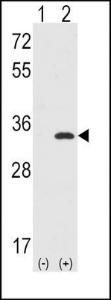 Anti-CDK1 Rabbit Polyclonal Antibody (APC (Allophycocyanin))