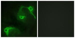 Immunofluorescence analysis of COS7 cells using Anti-VAV2 Antibody. The right hand panel represents a negative control, where the antibody was pre-incubated with the immunising peptide