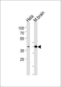 Anti-ATF2 Rabbit Polyclonal Antibody (PE (Phycoerythrin))