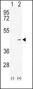 Anti-ADH4 Rabbit Polyclonal Antibody