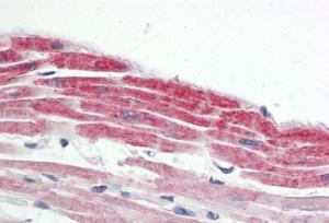 Anti-NKX2-5 Antibody (A83026) (375 µg/ml) staining of paraffin embedded Human Heart Steamed antigen retrieval with citrate buffer pH 6, AP-staining