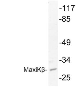 Western blot analysis of lysate from HepG2 cells using Anti-MaxiKbeta Antibody