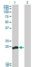 Anti-DUSP3 Mouse Monoclonal Antibody [clone: 5B7]