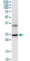 Anti-BDNF Mouse Monoclonal Antibody [clone: 1B10]