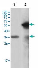 Anti-KMT2A Mouse Monoclonal Antibody [clone: 10F8D7]