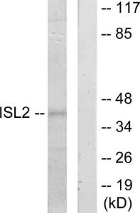 Western blot analysis of lysates from 293 cells using Anti-ISL2 Antibody. The right hand lane represents a negative control, where the Antibody is blocked by the immunising peptide