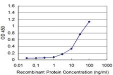 Anti-DUSP3 Mouse Monoclonal Antibody [clone: 5B7]