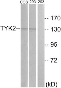 Western blot analysis of lysates from 293 and COS7 cells, treated with heat shock using Anti-TYK2 Antibody. The right hand lane represents a negative control, where the antibody is blocked by the immunising peptide