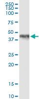 Anti-HOXA1 Rabbit Polyclonal Antibody