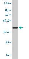 Anti-NME2 Mouse Monoclonal Antibody [clone: 1A9]