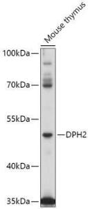 Western blot analysis of extracts of Mouse thymus, using Anti-DPH2 Antibody (A309013) at 1:1,000 dilution. The secondary antibody was Goat Anti-Rabbit IgG H&L Antibody (HRP) at 1:10,000 dilution.