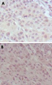 Anti-KMT2A Mouse Monoclonal Antibody [clone: 10F8D7]