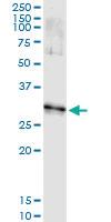 Anti-DLX1 Antibody Pair