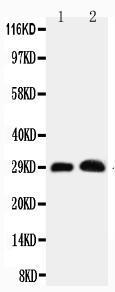 Anti-Aquaporin 5 Rabbit Polyclonal Antibody