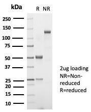 SDS-PAGE analysis of Anti-TSH beta Antibody [TSHb/7001R] under non-reduced and reduced conditions; showing intact IgG and intact heavy and light chains, respectively. SDS-PAGE analysis confirms the integrity and purity of the antibody