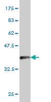 Anti-PSMD6 Mouse Monoclonal Antibody [clone: 1C1]