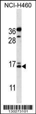 Anti-BGLAP Rabbit Polyclonal Antibody (HRP (Horseradish Peroxidase))