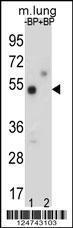 Anti-TOX3 Rabbit Polyclonal Antibody (PE (Phycoerythrin))