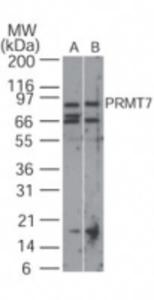 Anti-PRMT7 Rabbit Polyclonal Antibody