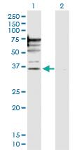 Anti-PSMD6 Rabbit Polyclonal Antibody