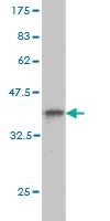 Anti-FRA10AC1 Mouse Monoclonal Antibody [clone: 2C4]