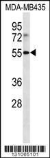 Anti-LILRB4 Rabbit Polyclonal Antibody (AP (Alkaline Phosphatase))