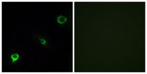 Immunofluorescence analysis of COS7 cells using Anti-TYK2 Antibody. The right hand panel represents a negative control, where the antibody was pre-incubated with the immunising peptide