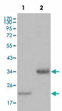 Anti-LPA Mouse Monoclonal Antibody [clone: 8F6A9,8H5C5]