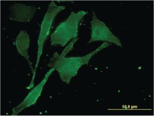 Anti-MBTPS2 Mouse Monoclonal Antibody [clone: 1A3]