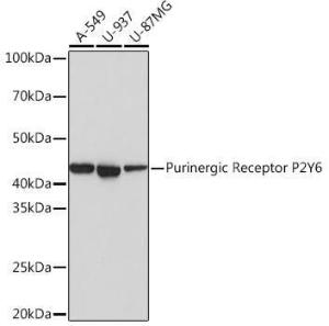 Western blot analysis of extracts of various cell lines, using Anti-P2Y6 Antibody [ARC0831] (A309014) at 1:1,000 dilution. The secondary antibody was Goat Anti-Rabbit IgG H&L Antibody (HRP) at 1:10,000 dilution.