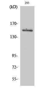 Western blot analysis of various cells using Anti-TYK2 Antibody