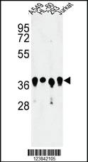 Anti-ARGLU1 Rabbit Polyclonal Antibody