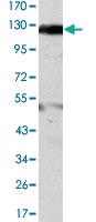 Anti-JAK2 Mouse Monoclonal Antibody [clone: 1C1]