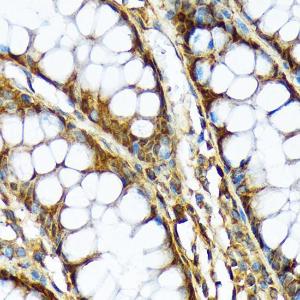 Immunohistochemistry analysis of paraffin-embedded human colon tissue using Anti-ABCF1 Antibody [ARC2199] (A306091) at a dilution of 1:100 (40x lens) Perform microwave antigen retrieval with 10 mM Tris/EDTA buffer pH 90 before commencing with IHC staining protocol