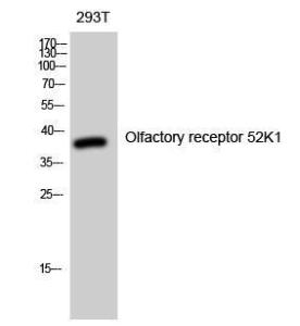 Western blot analysis of 293T cells using Anti-OR52K1 Antibody