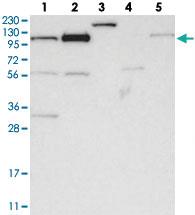 Anti-AASS Rabbit Polyclonal Antibody