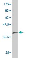 Anti-TBX3 Mouse Monoclonal Antibody [clone: 7B3]