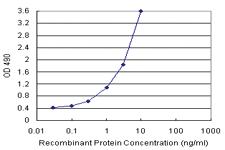 Anti-SLA2 Polyclonal Antibody Pair