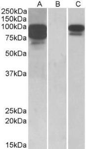 HEK293 lysate (10ug protein in RIPA buffer) overexpressing Human PCSK9 with C-terminal MYC tag probed with Anti-PCSK9 Antibody (A84632) (1 µg/ml) in Lane A and probed with anti-MYC Tag (1/1000) in lane C