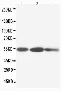 Anti-Cytokeratin 8 Rabbit Polyclonal Antibody