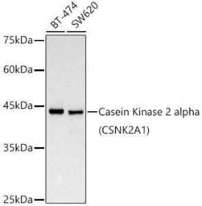 Western blot analysis of various lysates, using Anti-CSNK2A1 Antibody [ARC0163] (A307775) at 1:1000 dilution. The secondary Antibody was Goat Anti-Rabbit IgG H&L Antibody (HRP) at 1:10000 dilution. Lysates/proteins were present at 25 µg per lane