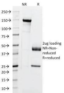 SDS-PAGE analysis of Anti-Cytokeratin 5 + 6 + 18 Antibody [LP34] under non-reduced and reduced conditions; showing intact IgG and intact heavy and light chains, respectively. SDS-PAGE analysis confirms the integrity and purity of the antibody.