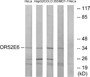 Western blot analysis of lysates from HeLa, HepG COLO, and MCF-7 cells using Anti-OR52E6 Antibody. The right hand lane represents a negative control, where the Antibody is blocked by the immunising peptide