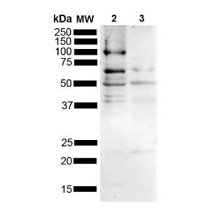 Western blot analysis of mouse, rat brain showing detection of Multiple bands due to different isoforms/aggregation states Tau protein using Anti-Truncated Tau Fragment (Aa 297-391) (dGAE) Antibody (A304949) at 1:1,000 for 2 hours at room temperature with shaking